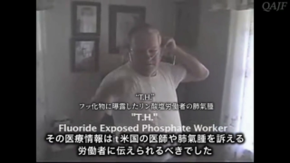 フッ素は猛毒｜水道水、歯磨き粉、フライパン、歯科のフッ素塗布
